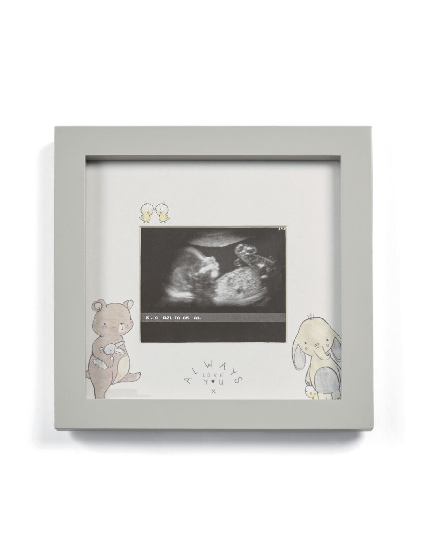 إطار صور الموجات الصوتية أولويز لاف يو - رمادي image number 1